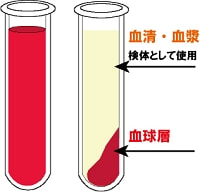 血液の測定方法